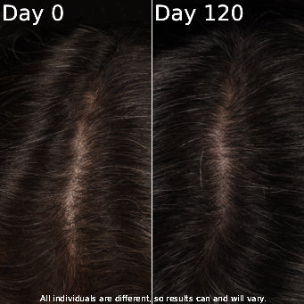 Comparison of hair texture on Day 0 and Day 120 with a dark background.