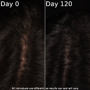 Side-by-side comparison of hair texture on Day 0 and Day 120 with a disclaimer.