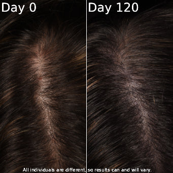 Side-by-side comparison of hair growth over 120 days with 'Day 0' on the left and 'Day 120' on the right.