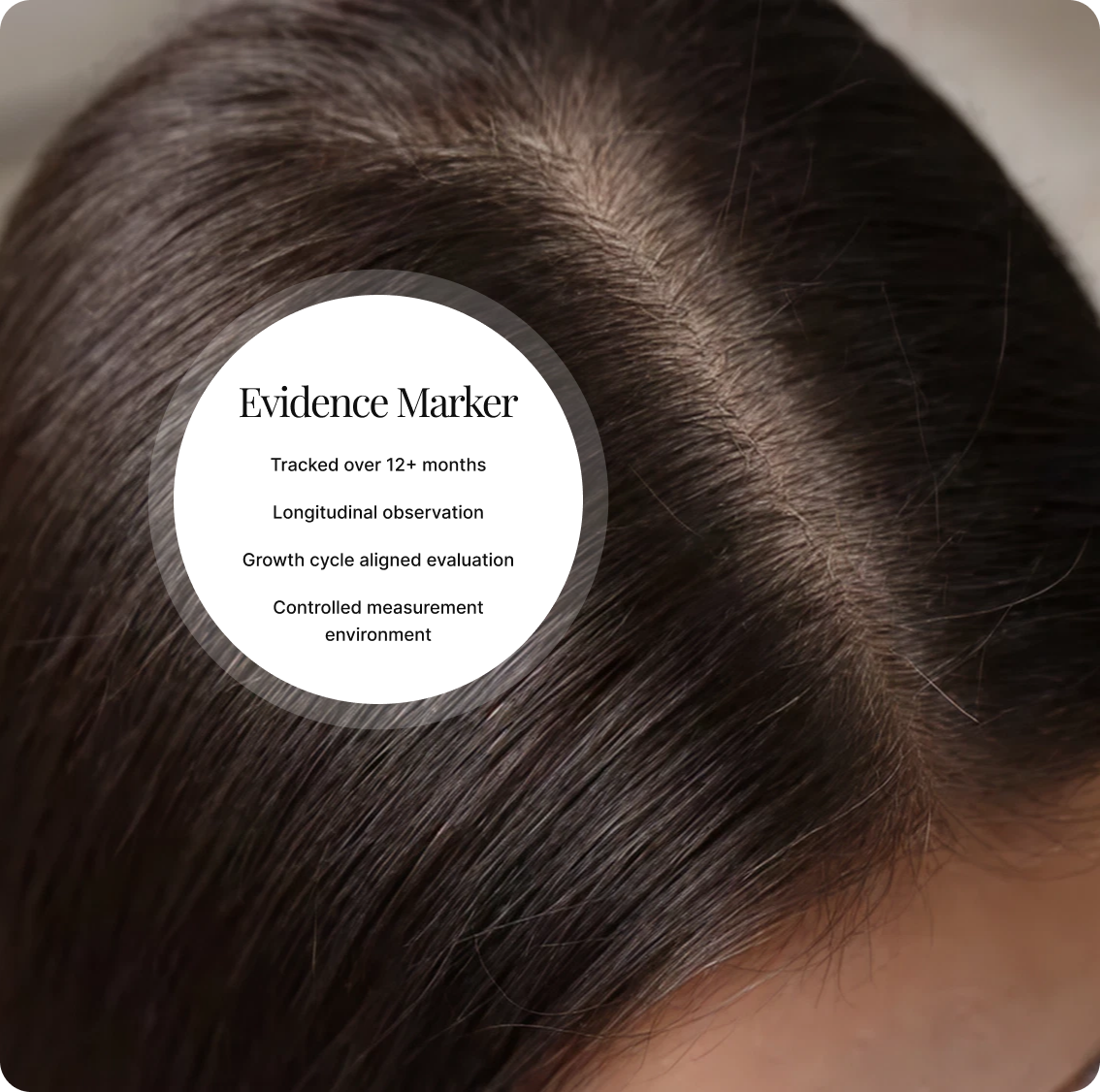 Photo of scalp with circular overlay showing Evidence Marker and four points about over 12 months hair evaluation
