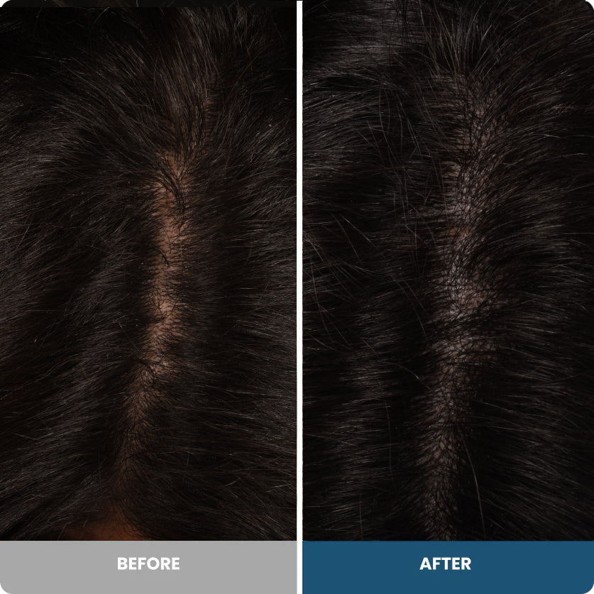 Before and after result