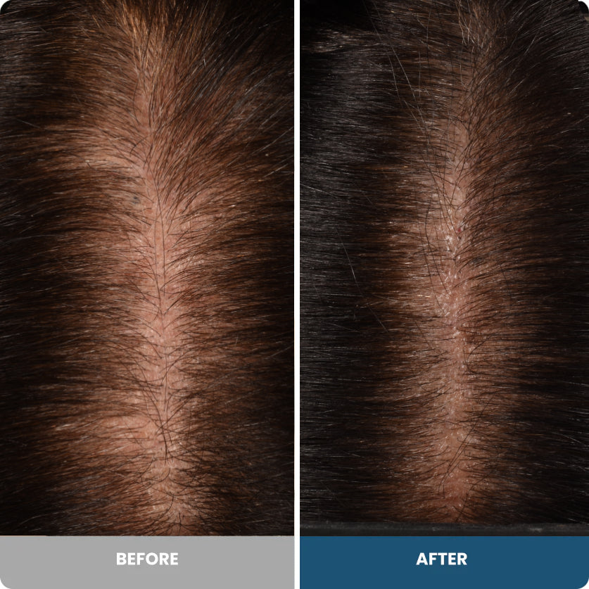 Before and after result