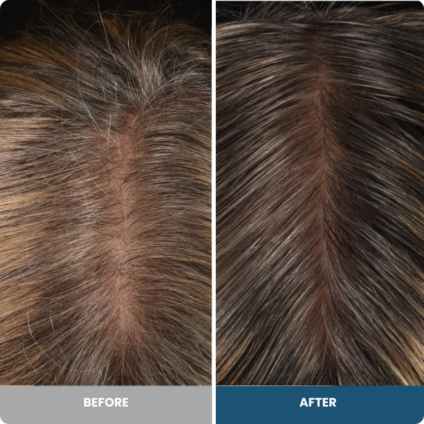 Before and after result