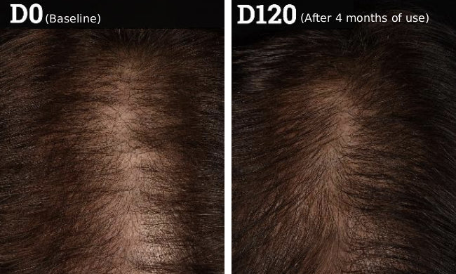 Before and after clinical example