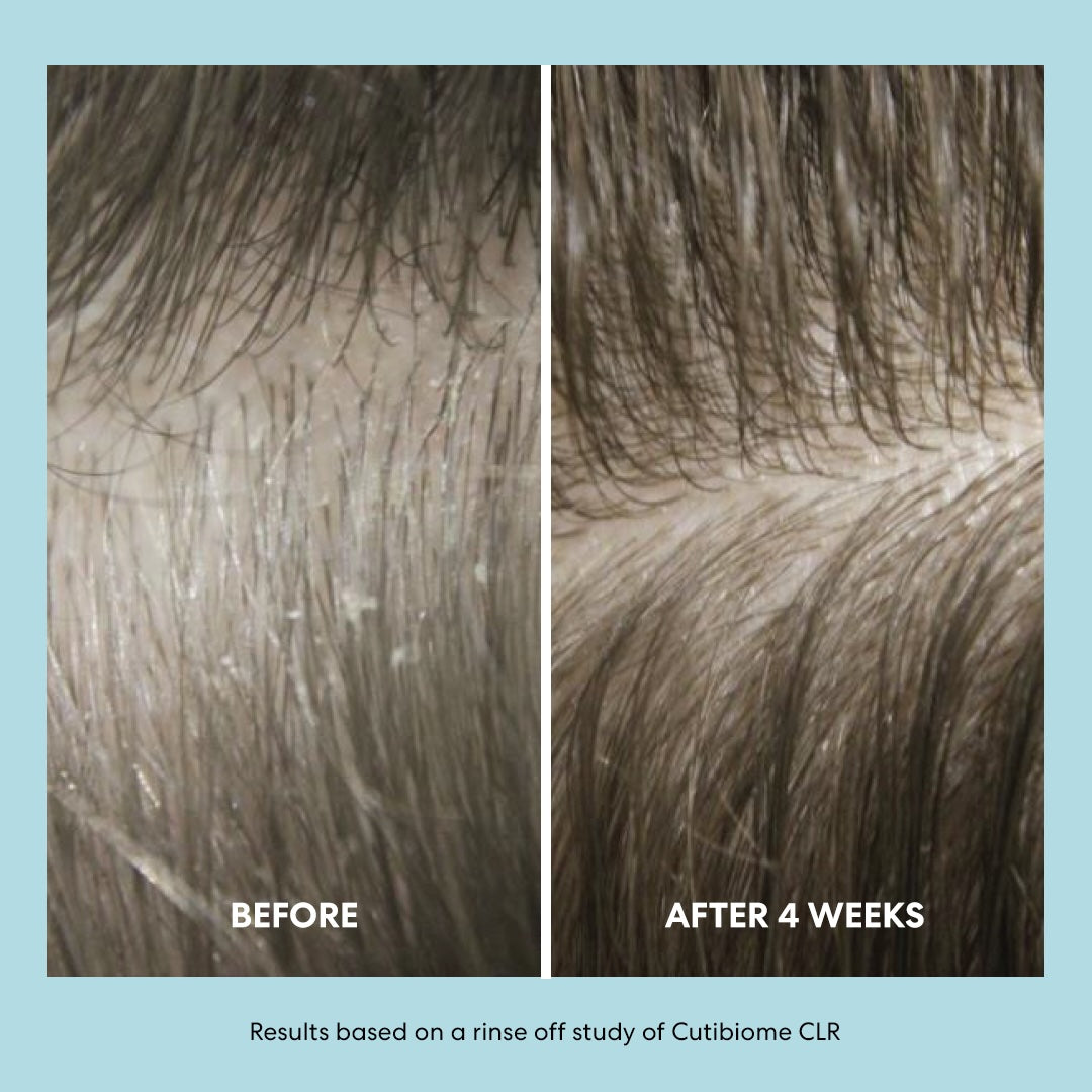 Before and after comparison of hair treatment with 'Before' showing dry, brittle hair and 'After 4 Weeks' showing improved hair health.