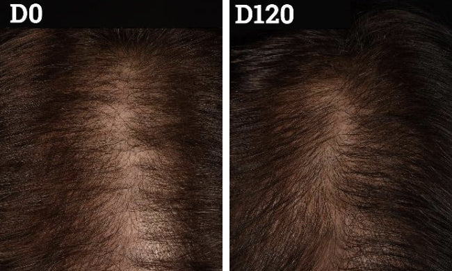 Clinical before and after
