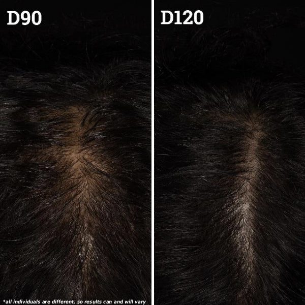 Scalp close-ups labeled D90 and D120 showing reduced hair thinning and visible regrowth by D120
