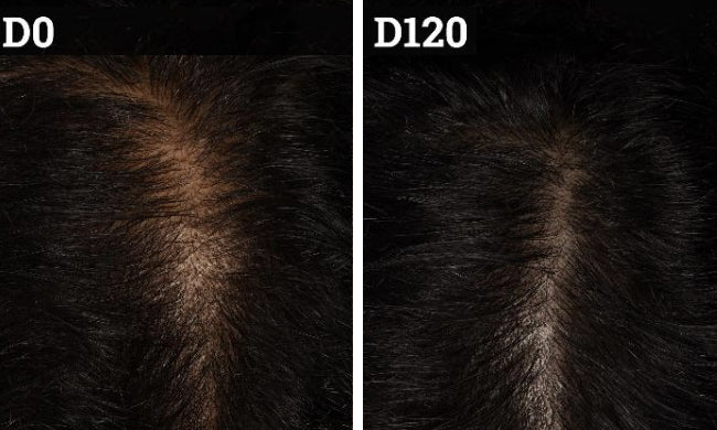 Regrowth example over time